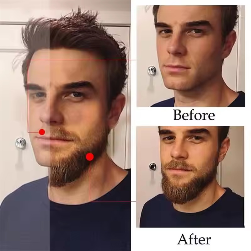 Fast Natural Mature Men Beard  - Plant Growth Regulator review and price